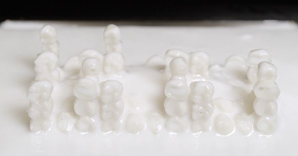 3D-печатная стоматологическая коронка